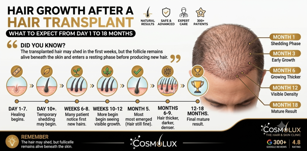 hair transplant Growth
