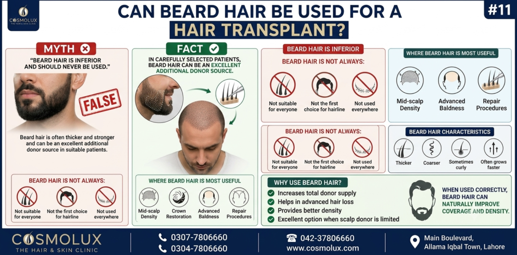 Beard Hair Be Used for a Hair Transplant