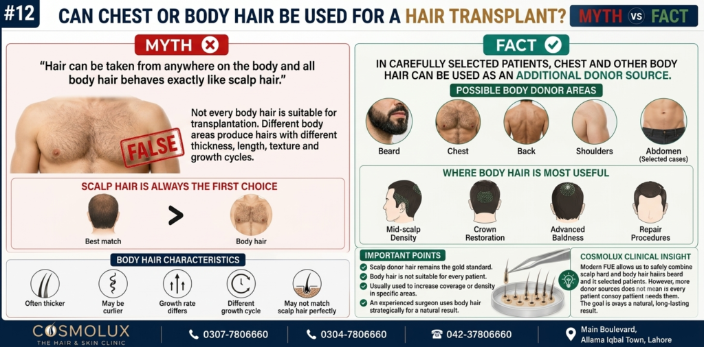 Chest or Body Hair Be Used for a Hair Transplant